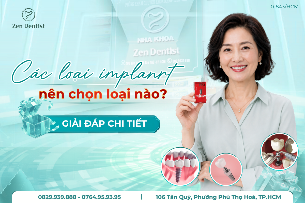 so sánh các loại trụ implant hiện nay