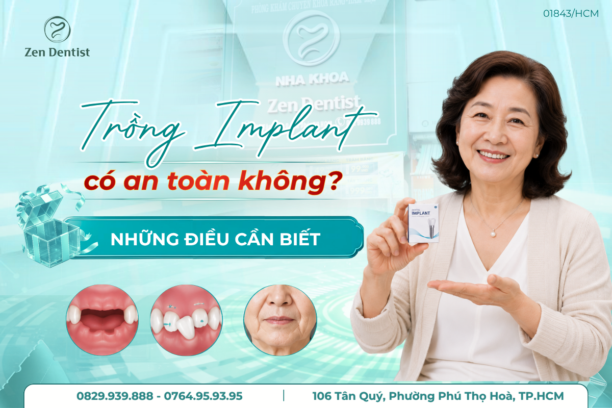 trồng Implant có an toàn không