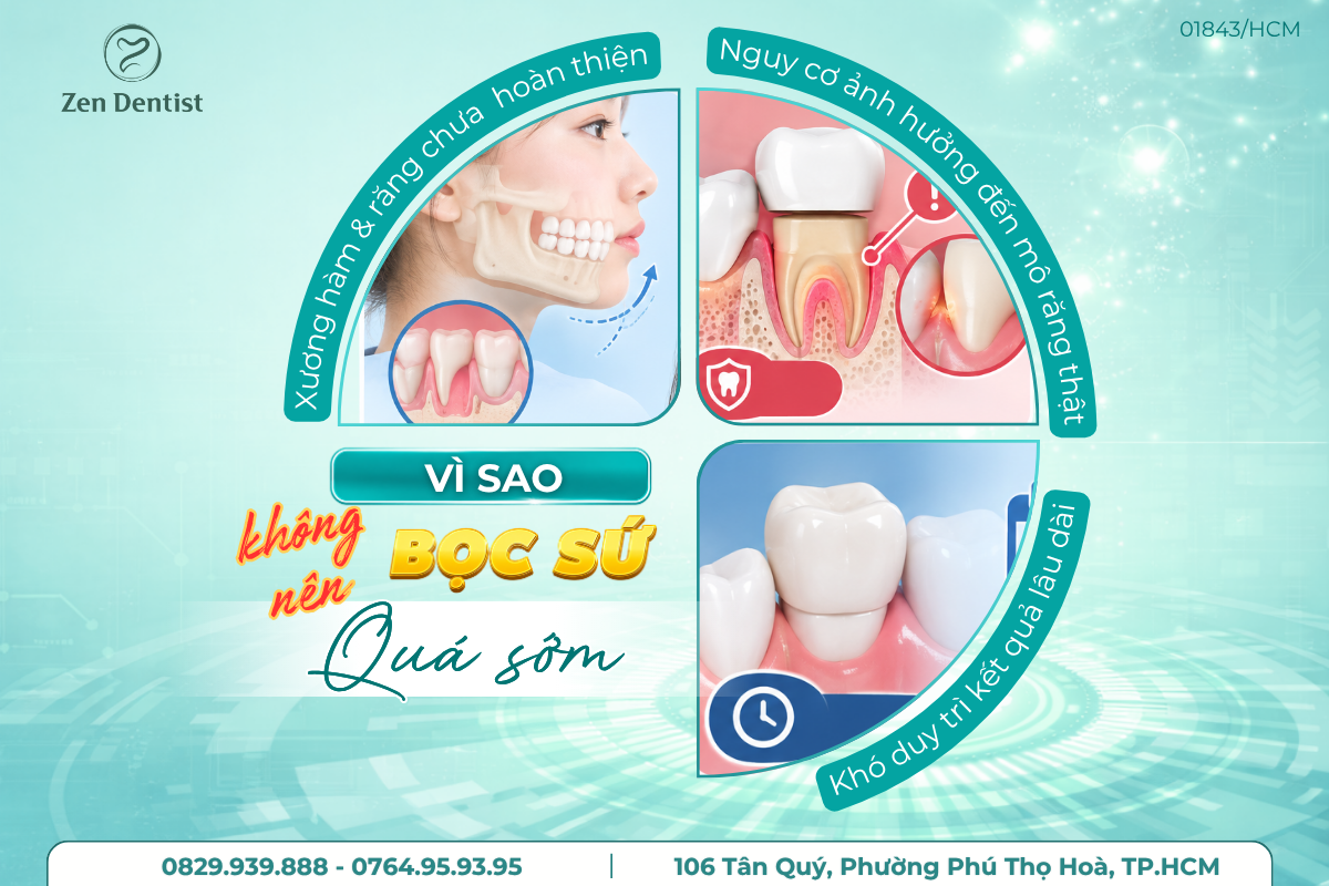 Vì sao không nên bọc răng sứ quá sớm?