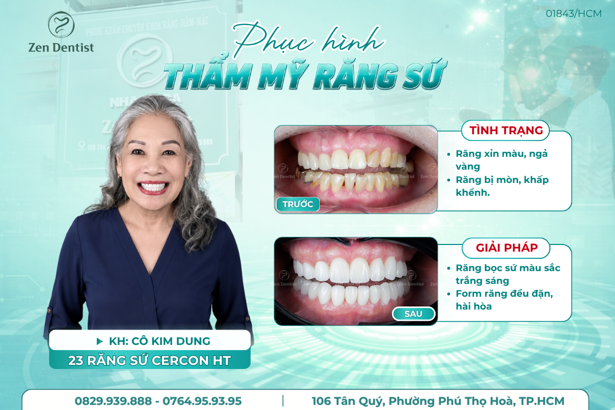 Khách hàng bọc răng sứ tại Zen Dentist