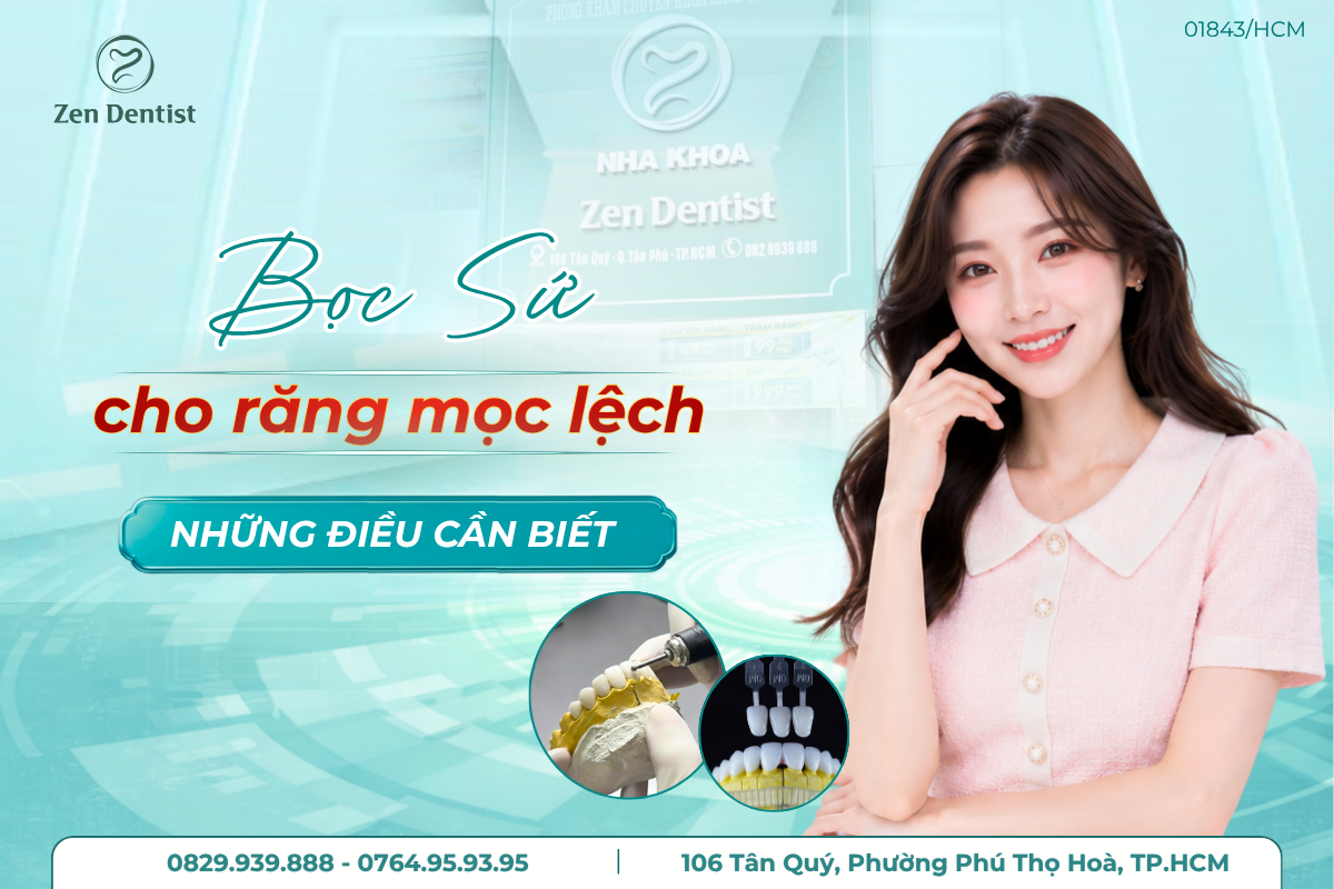 bọc sứ cho răng mọc lệch
