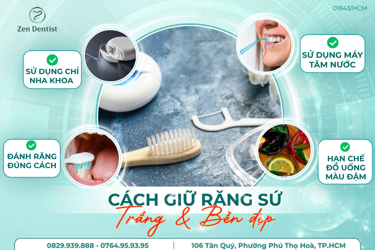 Cách giữ răng sứ luôn trắng và bền đẹp