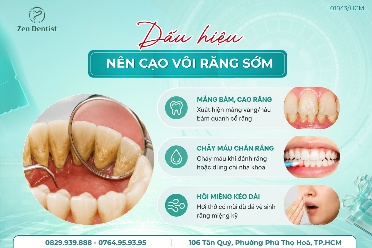Những dấu hiệu bạn nên cạo vôi răng sớm