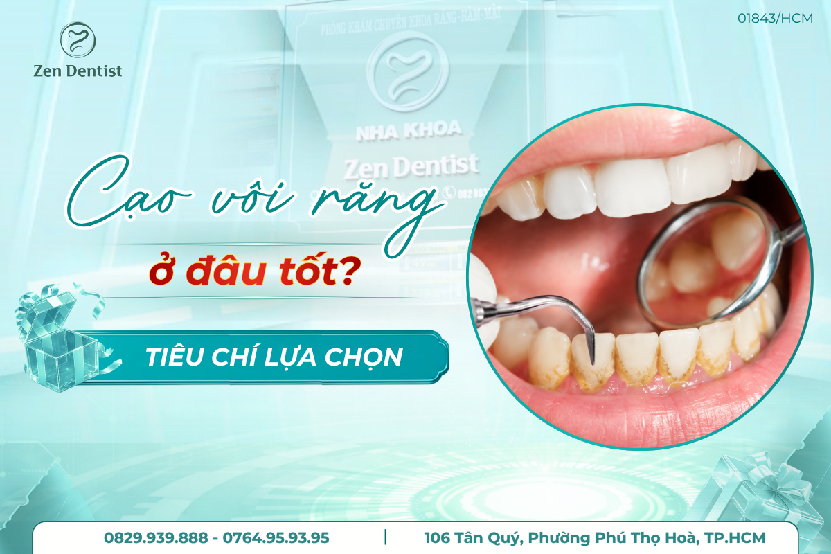 cạo vôi răng ở đâu tốt
