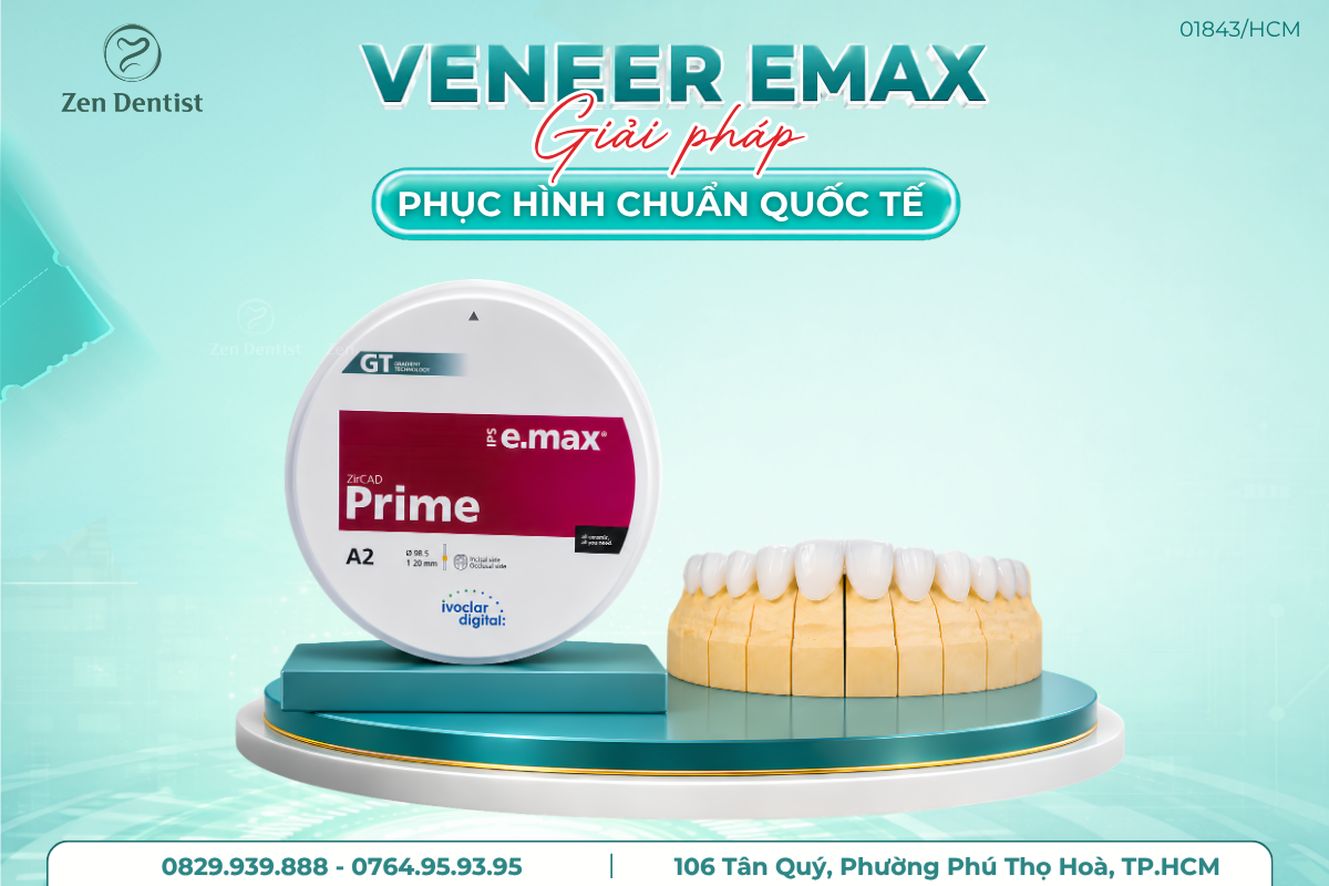 Veneer Emax giải pháp phục hình chuẩn quốc tế