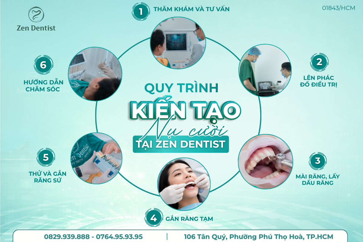 Quy trình kiến tạo nụ cười tại Zen Dentist