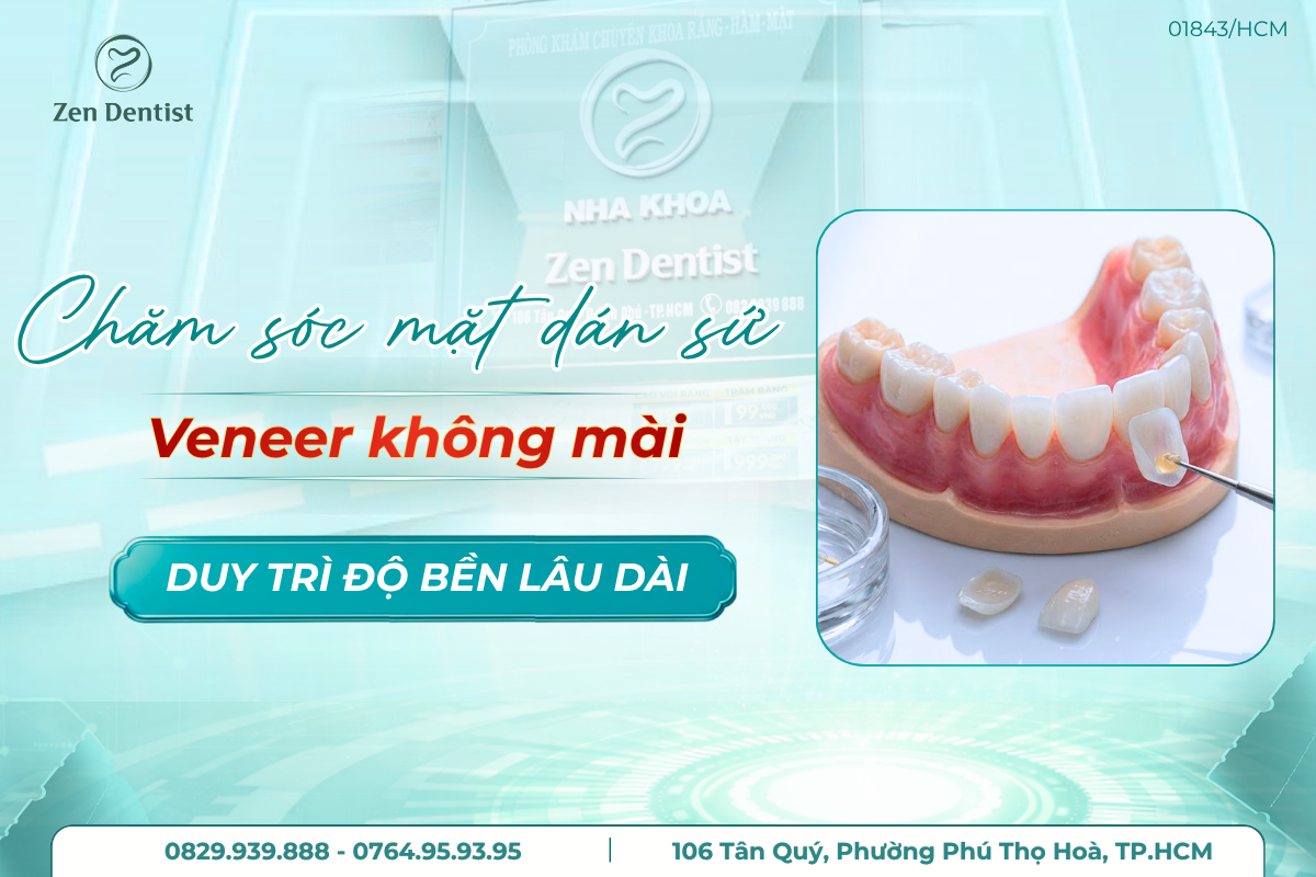 chăm sóc mặt dán sứ Veneer không mài