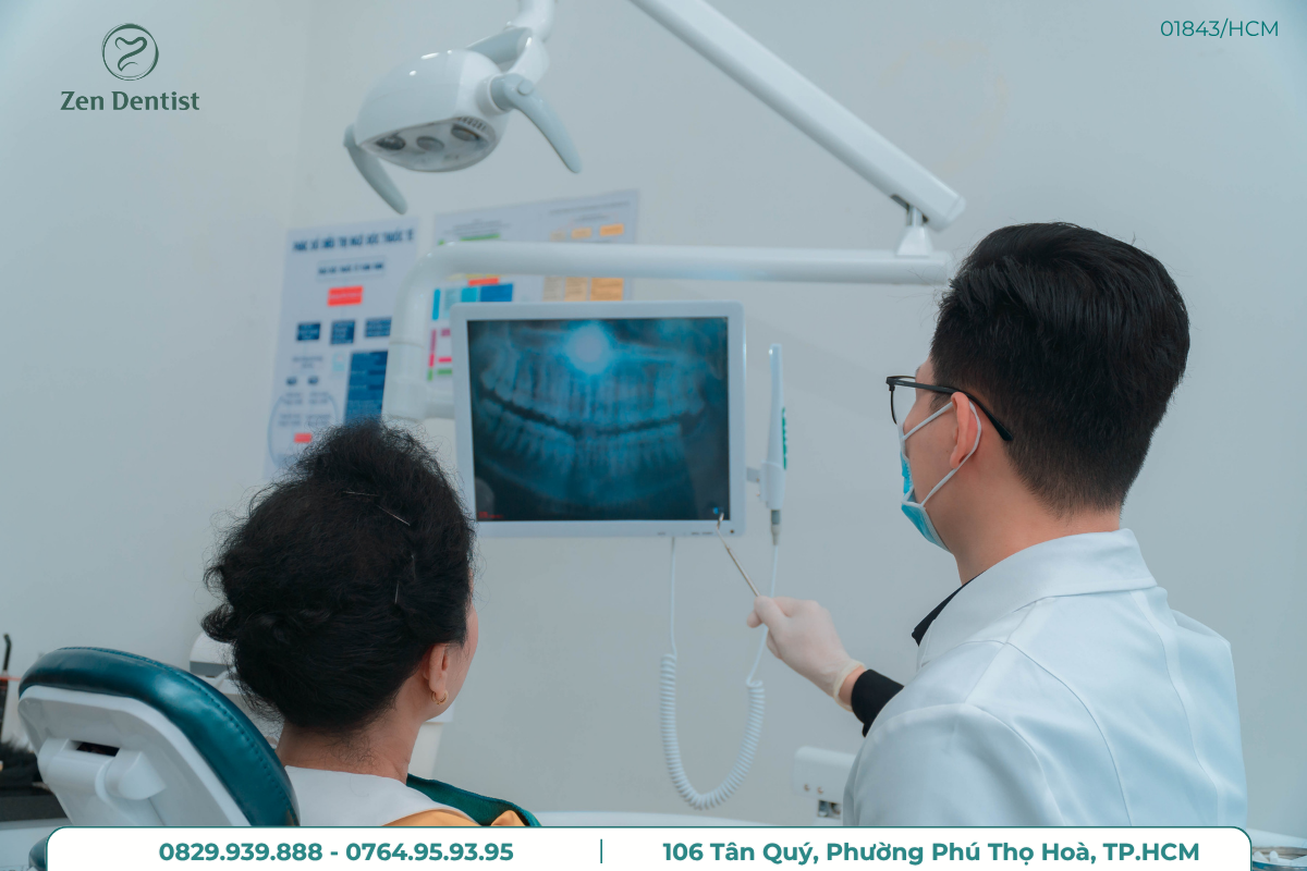 Điều trị tủy răng