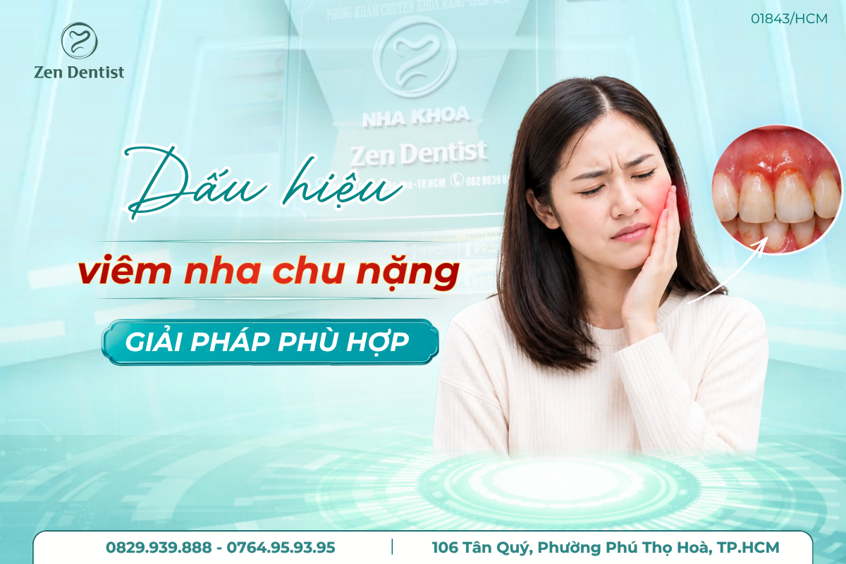 dấu hiệu viêm nha chu nặng