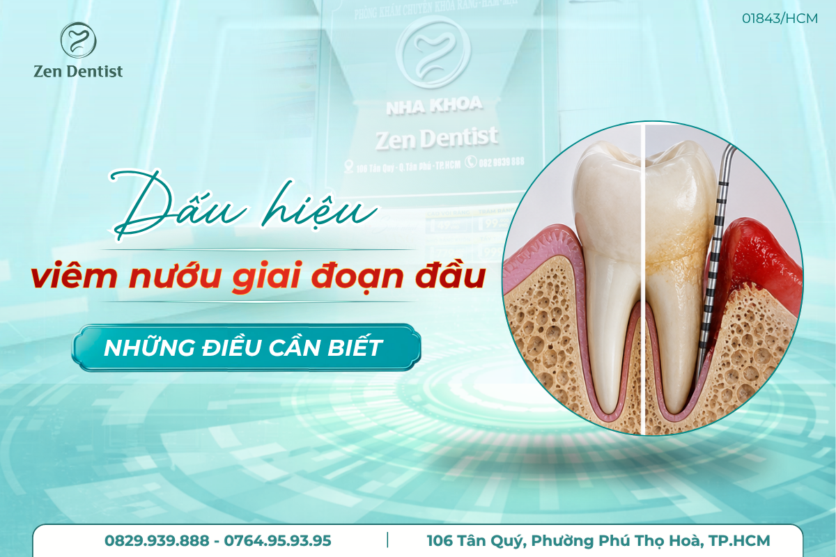 dấu hiệu viêm nướu giai đoạn đầu