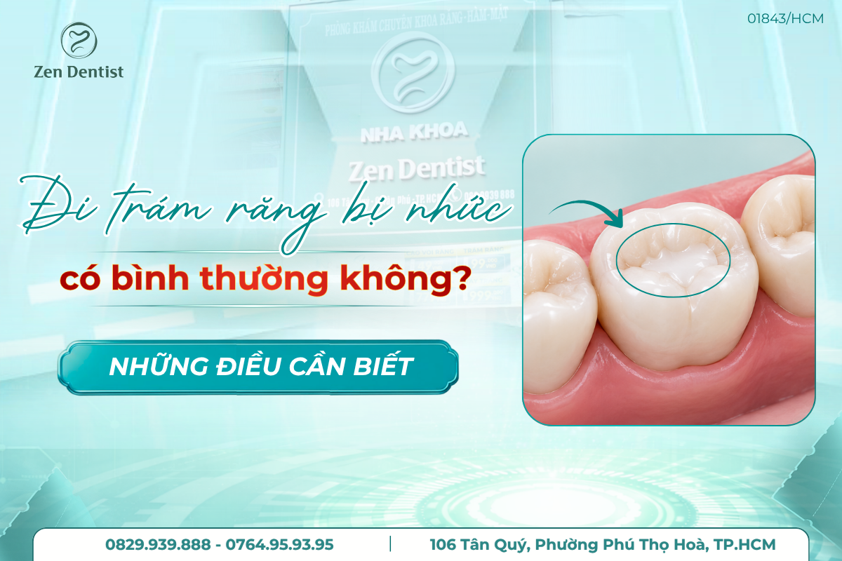 đi trám răng về bị nhức răng