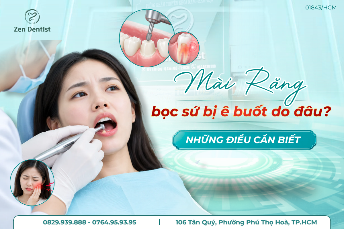 mài răng bọc sứ bị ê buốt