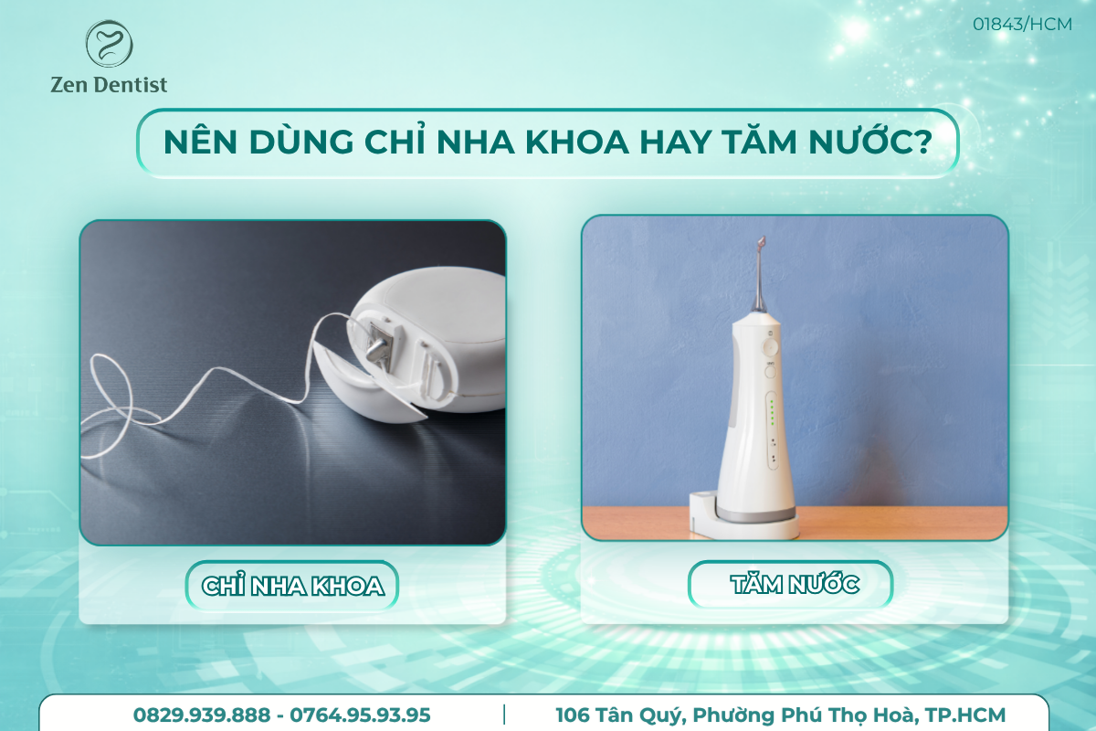Nên dùng chỉ nha khoa hay tăm nước?