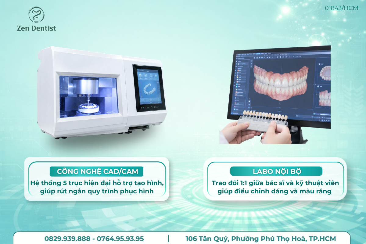 Công nghệ thiệt kế răng sứ hiện đại