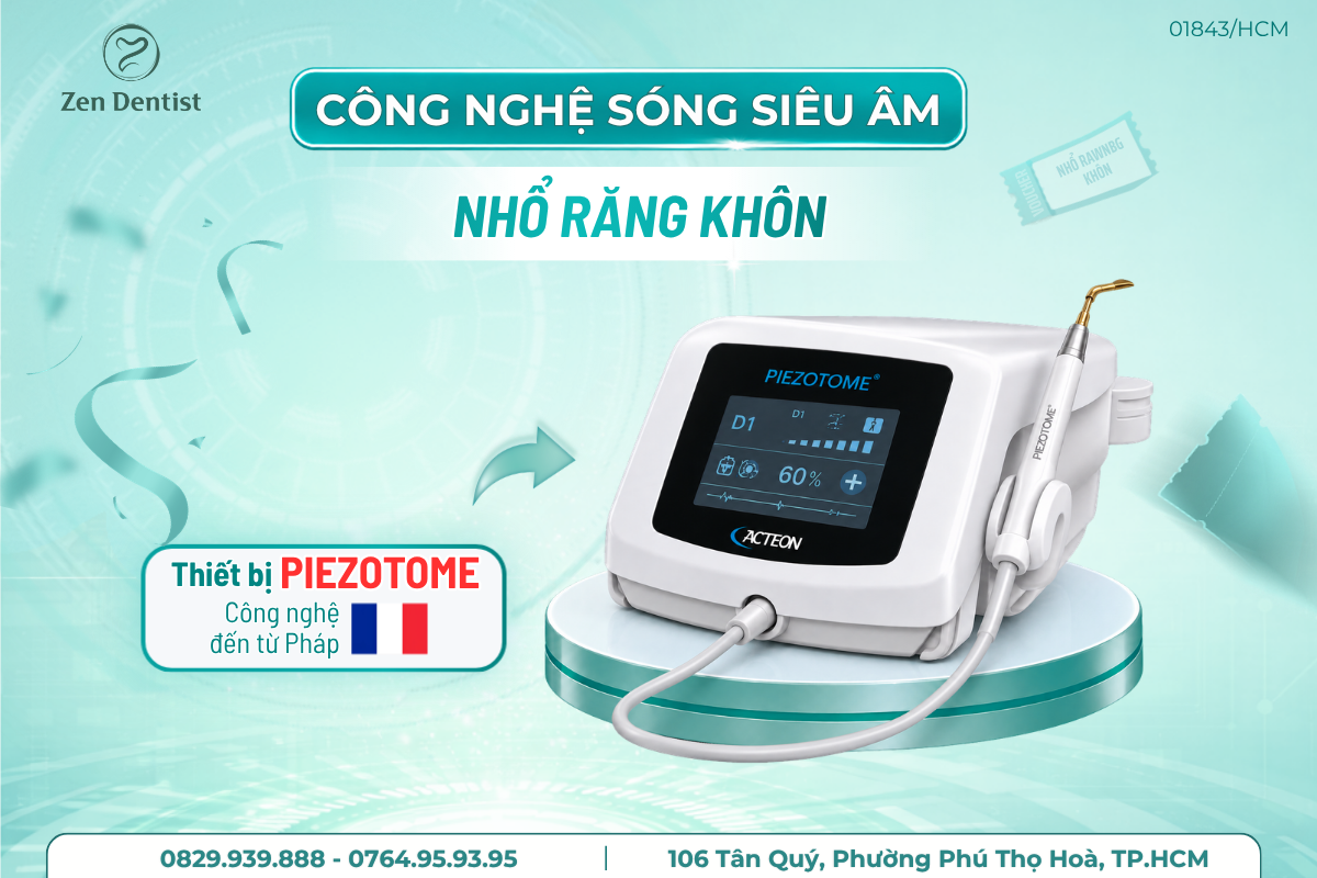 Nhổ răng khôn bằng công nghệ sóng siêu âm 