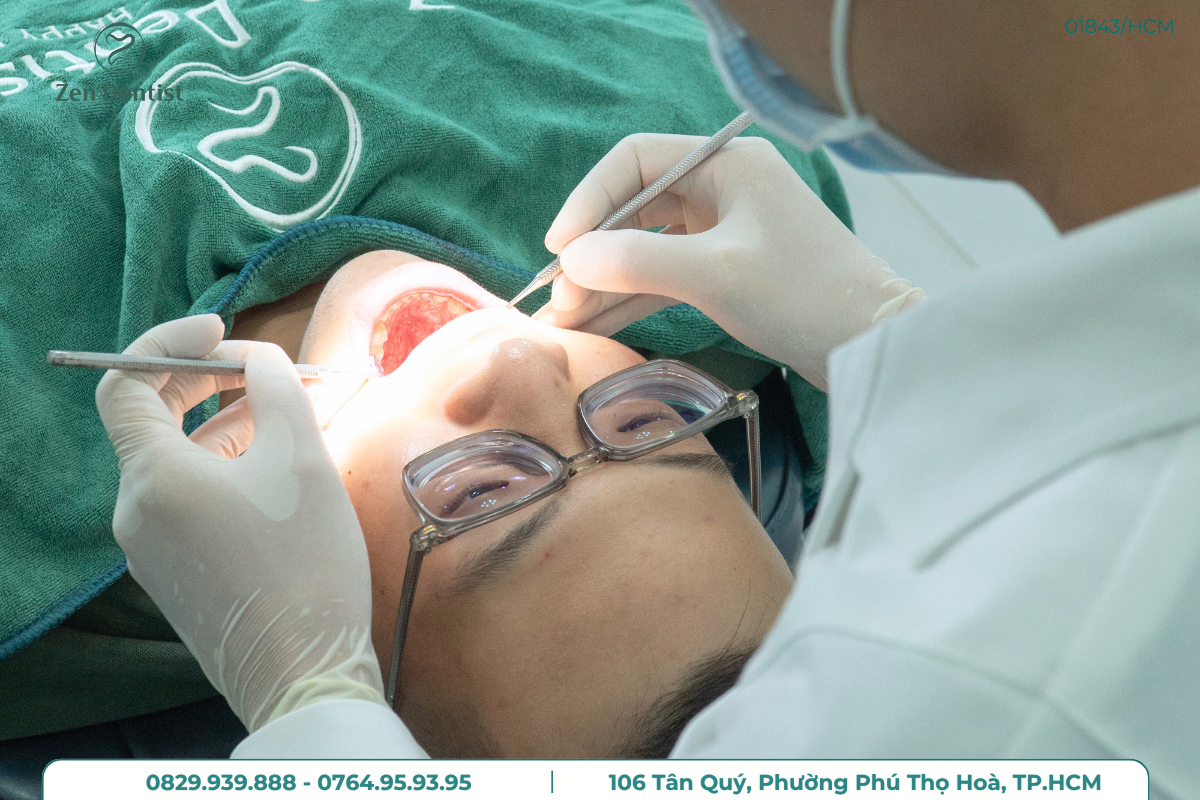 Tình trạng mọc của răng khôn
