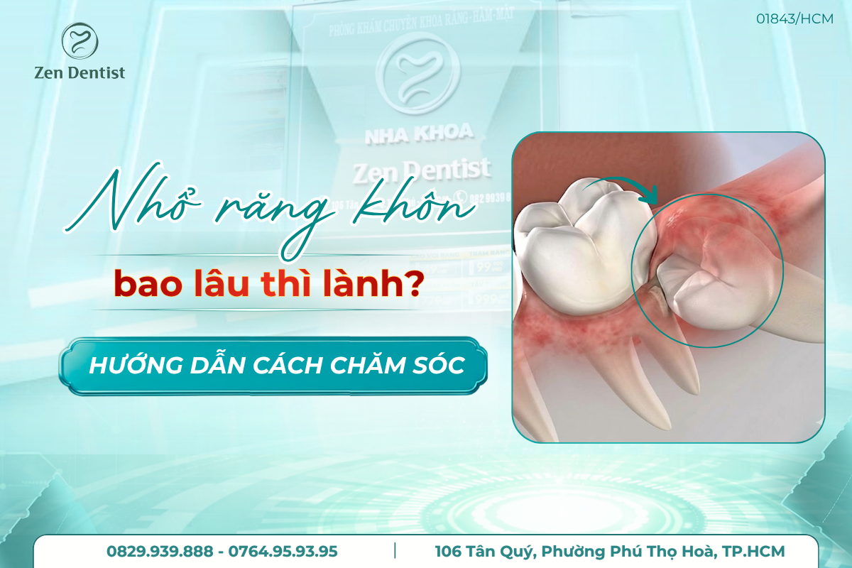 nhổ răng khôn bao lâu thì lành