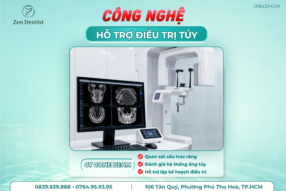 Công nghệ hỗ trợ điều trị tủy 