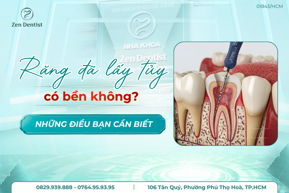 răng đã lấy tủy có bền không