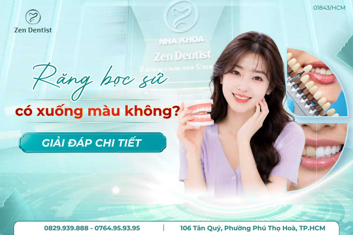 răng sứ có bị xuống màu