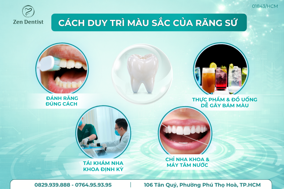 Cách duy trì màu sắc của răng sứ lâu dài