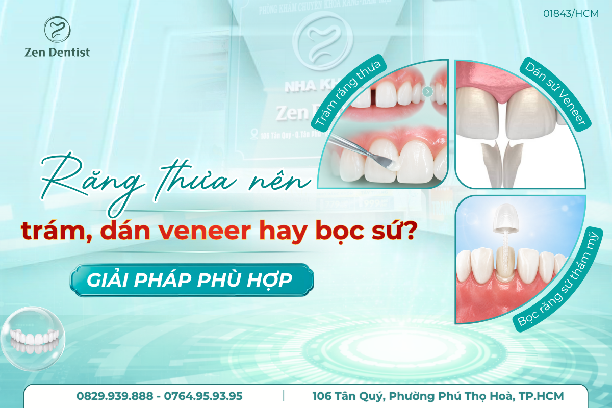 răng thưa nên trám, dán veneer hay bọc sứ